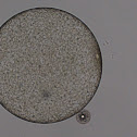 Centric Diatom