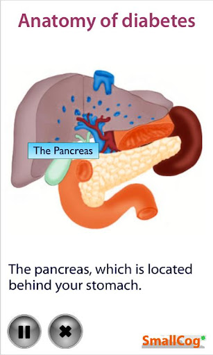 【免費醫療App】Anatomy of Diabetes-APP點子