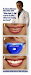 Camara Dental Intraoral