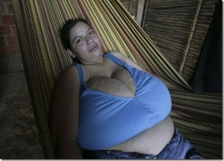 girl_with_20_pound_breasts_02