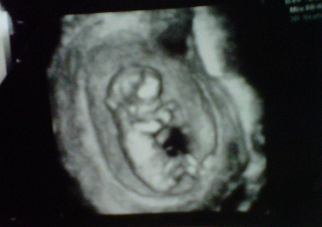 [baby13wks[4].jpg]