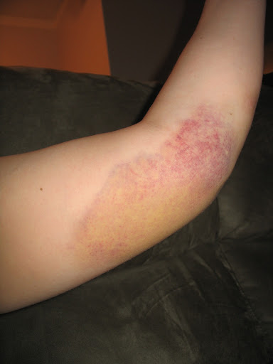 arm2.jpg
