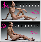 'Anorexia - France