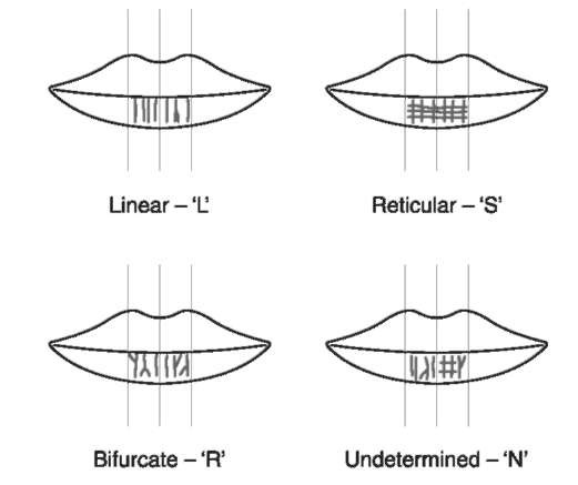 Types of patterns on the red parts of lips.
