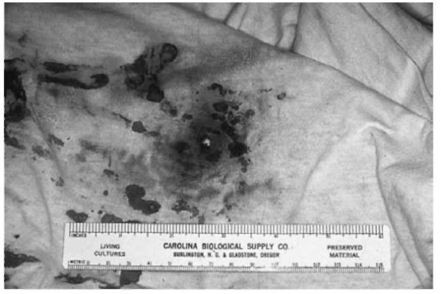 Carbonaceous material as well as gunshot residue may be deposited on victims' clothingif the handgun is discharged within range of fire of less then 1 m. Some gunshot residue from nitrates and vaporized lead will be invisible to the naked eye. All clothing should be collected and placed in separate paper containers for evaluation by the forensic laboratory.