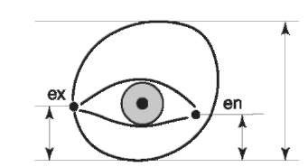 Relation of the eye to the orbit, The eye slit lies on the lower third of the orbital height. The entocanthion (en) lies more than 3 mm lateral to the medial orbital margin. The ecto-canthion (ex) lies on the lateral orbital margin or inside it,