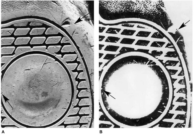  An enlarged area of (A) a shoe and (B) the respective known inked impression of that shoe, depict the many individual cuts and scratches. Individual random cuts, or groups of cuts, for example adjacent to the arrow on the top right, reflect sufficient size, shape, orientation and position features to make this shoe sole unique. Others, like the cut by the arrow on the left, although highly significant and important, reflect fewer features and would not be used alone to identify a shoe.