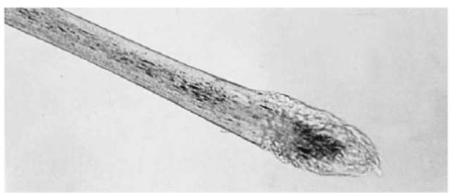 A human scalp hair with a telogen root.