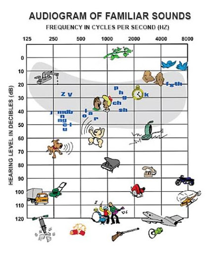 audiogram.jpg
