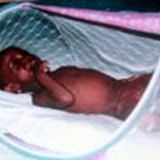  &ndash; Isha in bed net to keep bugs off her burns. .......© 2006 NHA Photos.