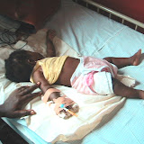  &ndash; Child with malaria at Dr. King Hospital. Freetown (James Mansaray, photographer)