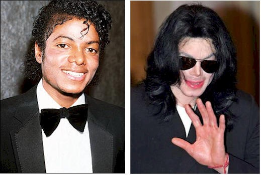 [before n after[2].jpg]