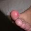 Engelure1.jpg