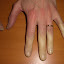 raynaud2.jpg