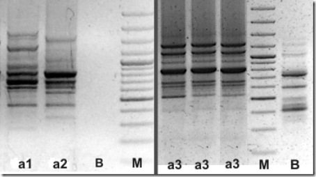 PCR