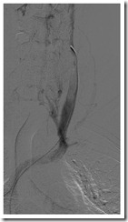 LIJV after 01 LIJV after 01