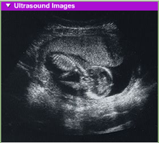 fetal development 4th month usg