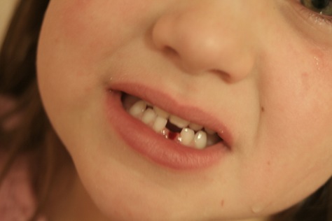 [KyliesLostTooth[2].jpg]