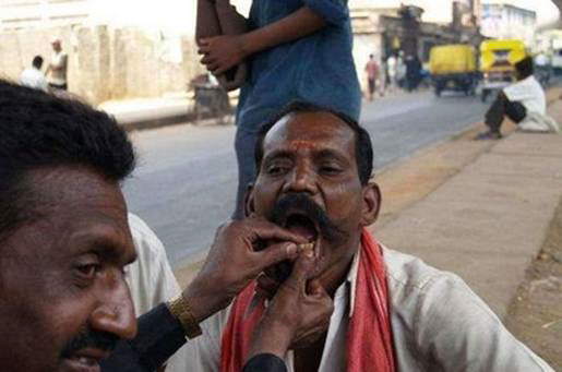 Street Dentists In India And China: Do you dare visit them? LOL