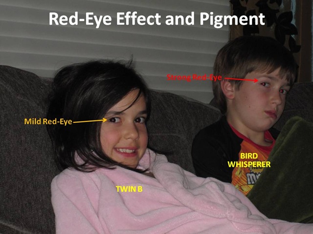 [Twin B BW Redeye[4].jpg]