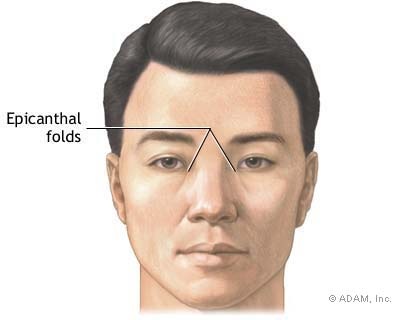 [epifold5.jpg]
