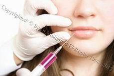 lip injection lip injection