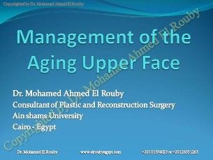 managment of upper face presentation