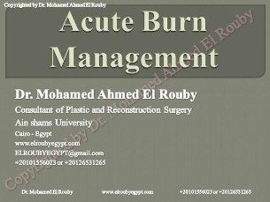 burn managment