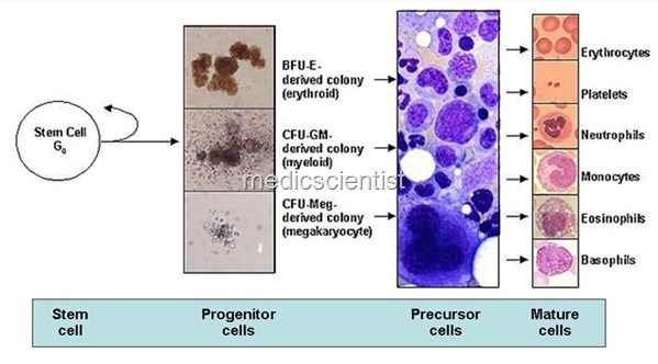 [Polycythemia Vera 1[4].jpg]