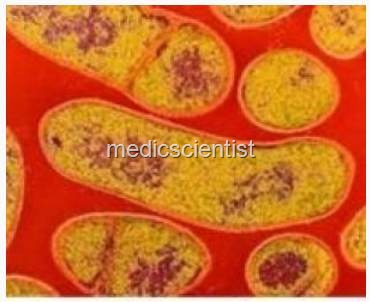 [BOTULISM 2[2].jpg]