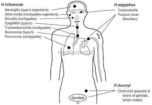 [HEMOPHILUS NFECTIONS  3[2].jpg]