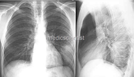 [Q - FEVER kk[2].jpg]