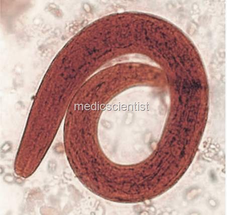 [STRONGYLOIDES STERCORALIS uy[2].jpg]