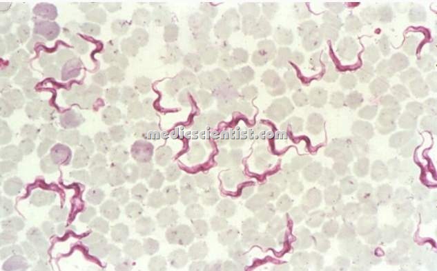 [protozoan Trypanosoma 1[2].jpg]