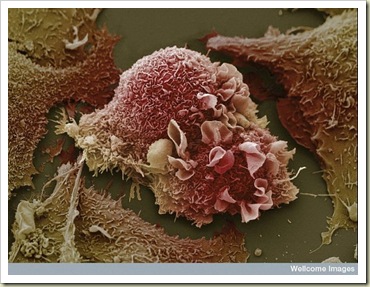 Lung Cancer Cells