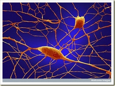 Purkinje Neurons