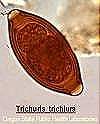 [Trichuris ovo[11].jpg]