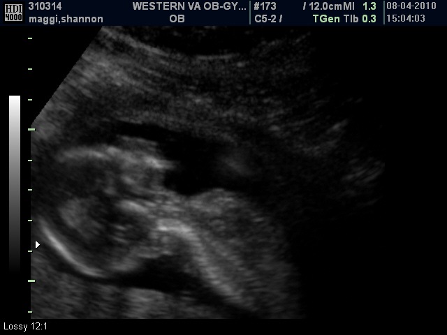 [BABY_13[1].jpg]