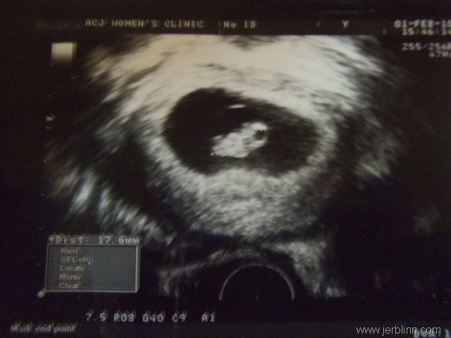 [Baby J 8 weeks[5].jpg]