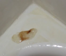 [mucous-plug3[2].jpg]