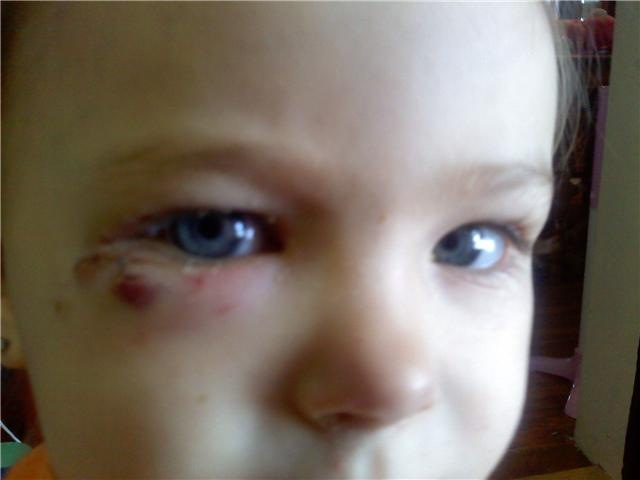 [Dog Bite Next Day[3].jpg]