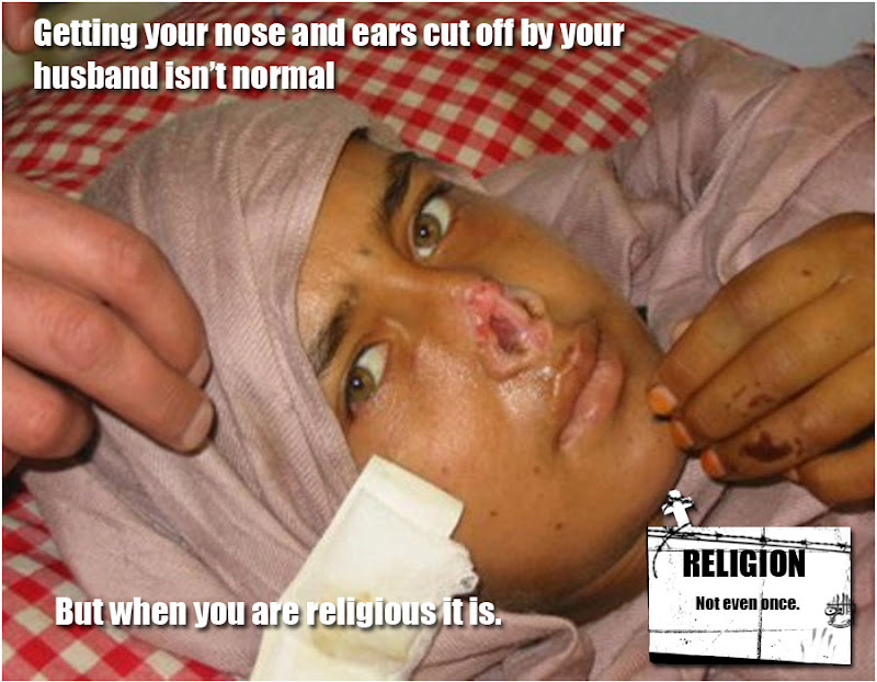 Young woman whose nose was cut of by a stupid Muslim man because he thinks Islam, the religion of peace gives him the right.