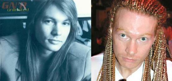 [axlroseplasticsurgery3.jpg]