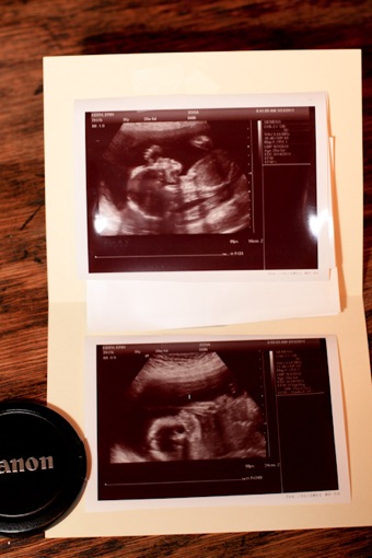 Baby 4