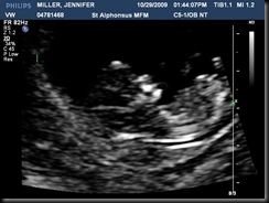 MILLERJENNIFER20091029134408454
