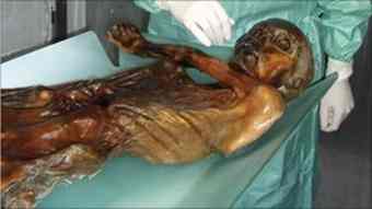 Oetzi was killed by an arrow wound to the shoulder an autopsy suggests Oetzi was killed by an arrow wound to the shoulder an autopsy suggests