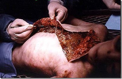 autopsia 1
