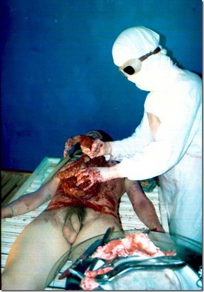 autopsia 4