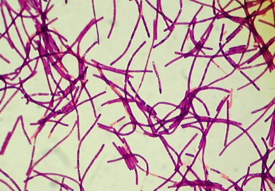 [Bacillus Anthracis[2].jpg]