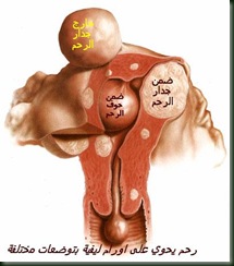 ليفى
